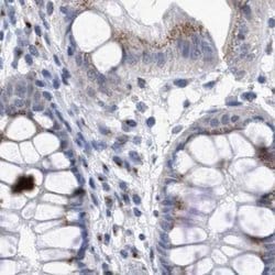 GM130/GOLGA2 Antibody, Novus Biologicals 0.1mL; Unlabeled:Antibodies, Polyclonal